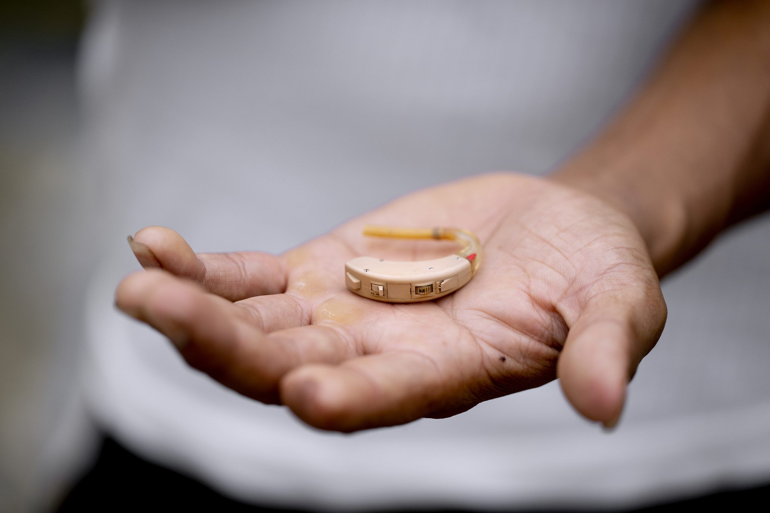 Ung mand holder ødelagt høreapparat i håndfladen